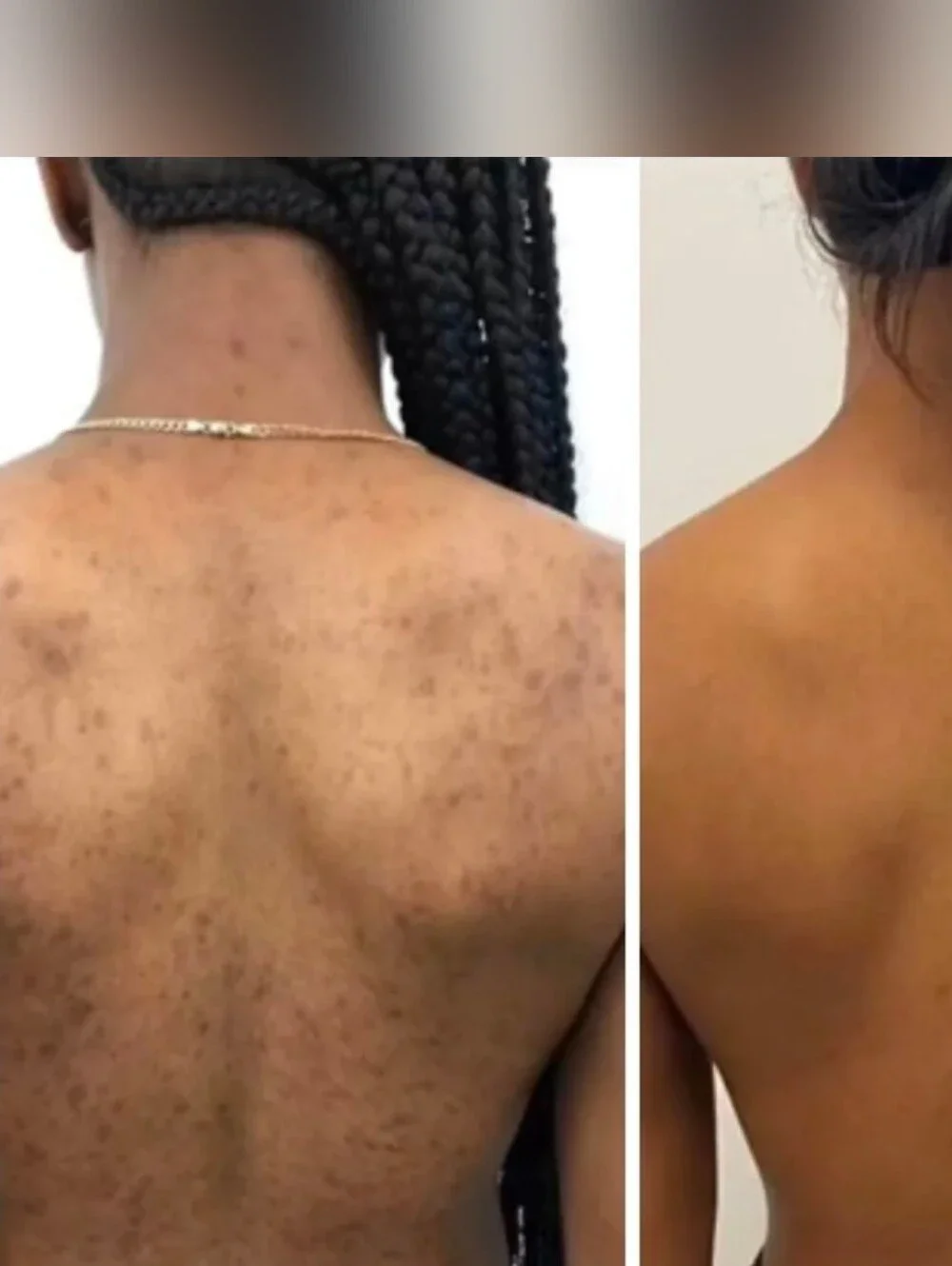 Ember & Root African Exfoliating Net (2-pack) - New in Packaging